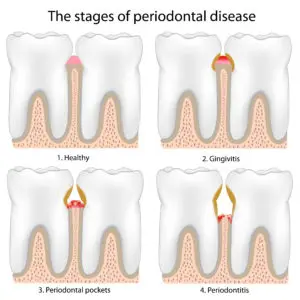 dentist San Antonio