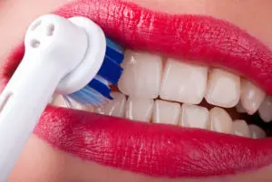 dental implants San Antonio