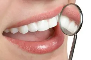 Zoom whitening San Antonio