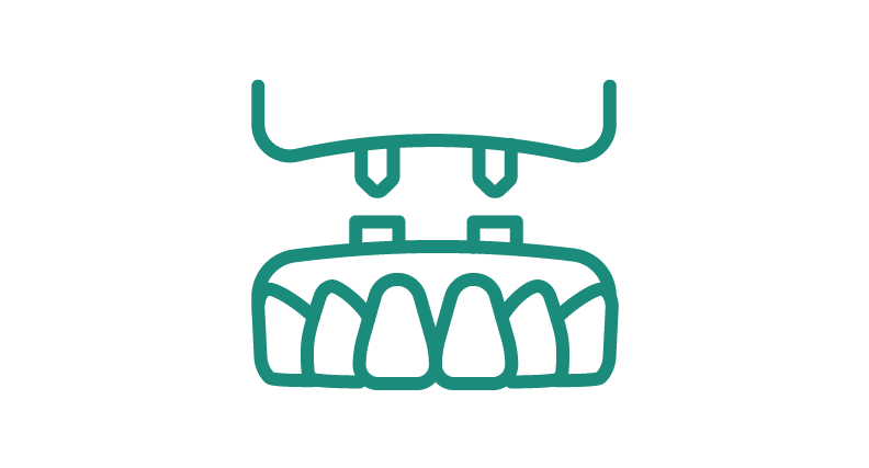 Dental Implants Icon | San Antonio Dentist