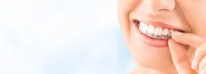 Invisalign San Antonio