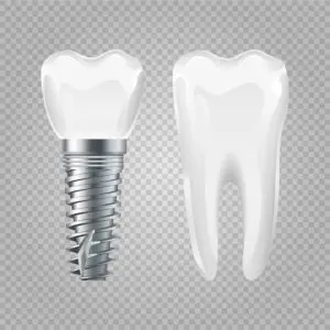 dental implants San Antonio