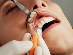 woman getting dental exam