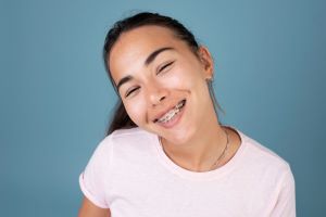 Ask these questions when being fitted for braces